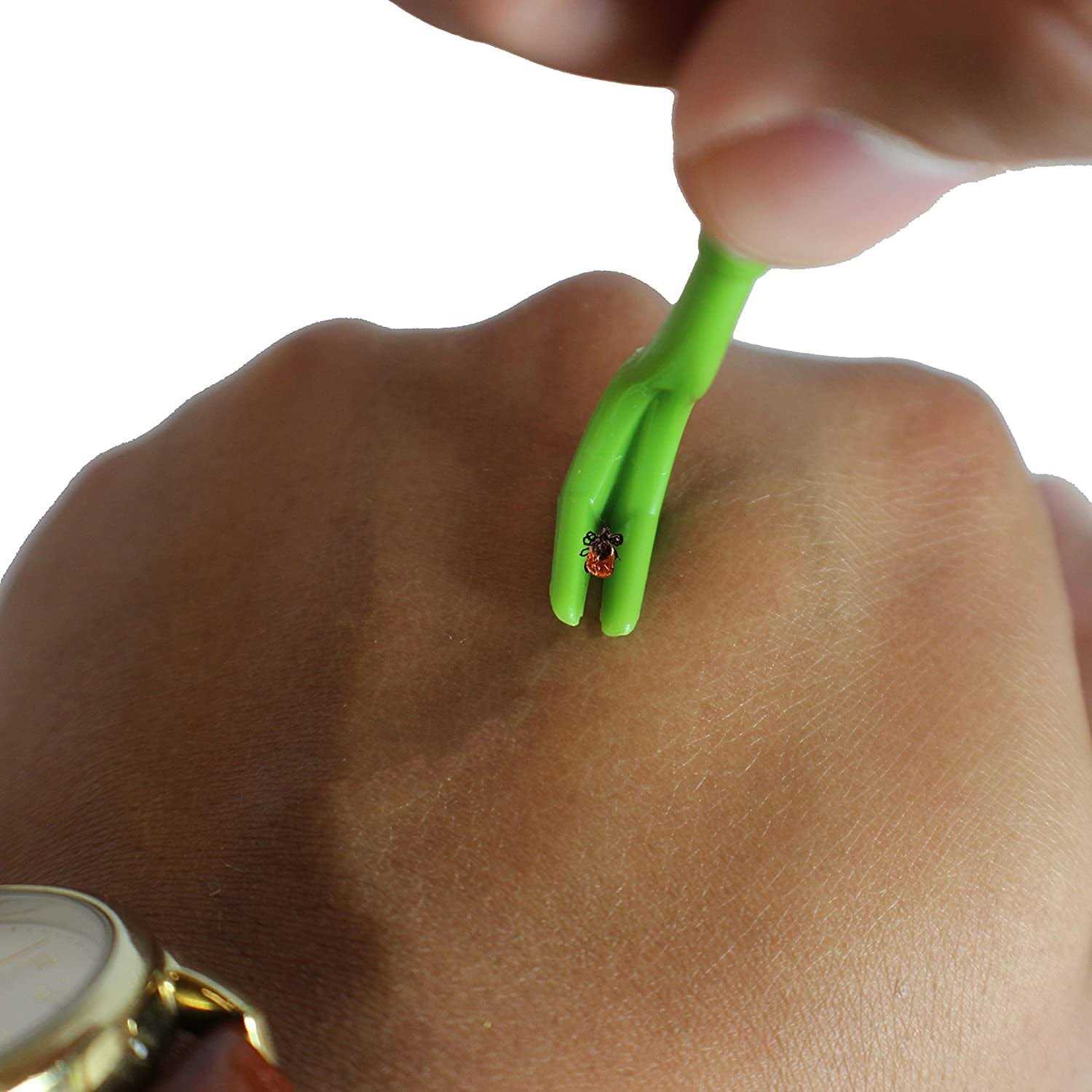 TickCheck Tick Remover Value 3 Pack Tick Remover Tools + Tick Identification Card - Healthber